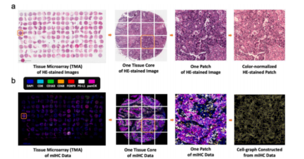 中国配资网开户 多步多模态集成生存模型（MMES）：整合HE与mIHC显著提升胃癌预后预测准确性